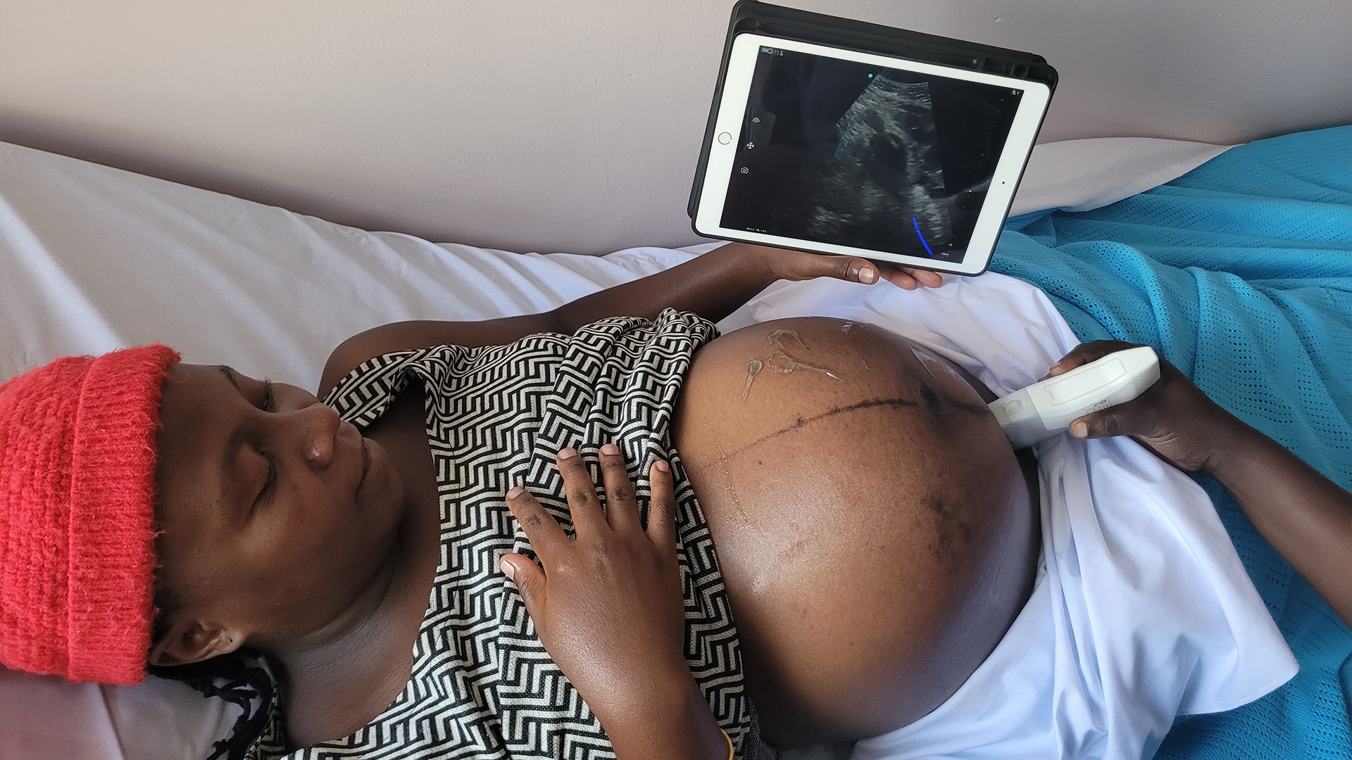 Pregnant woman receiving an ultrasound scan with the image shown on a handheld device